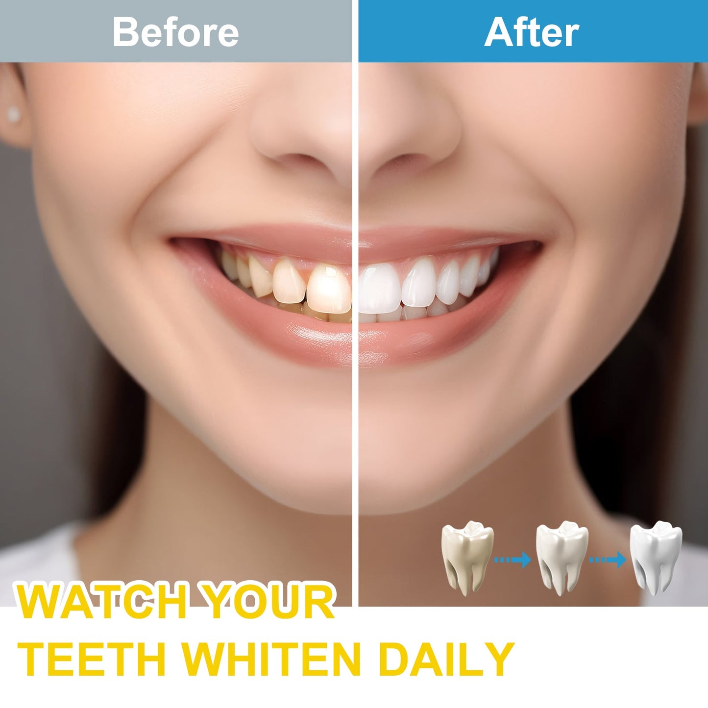GENKENT LED Light Whitening Kit
