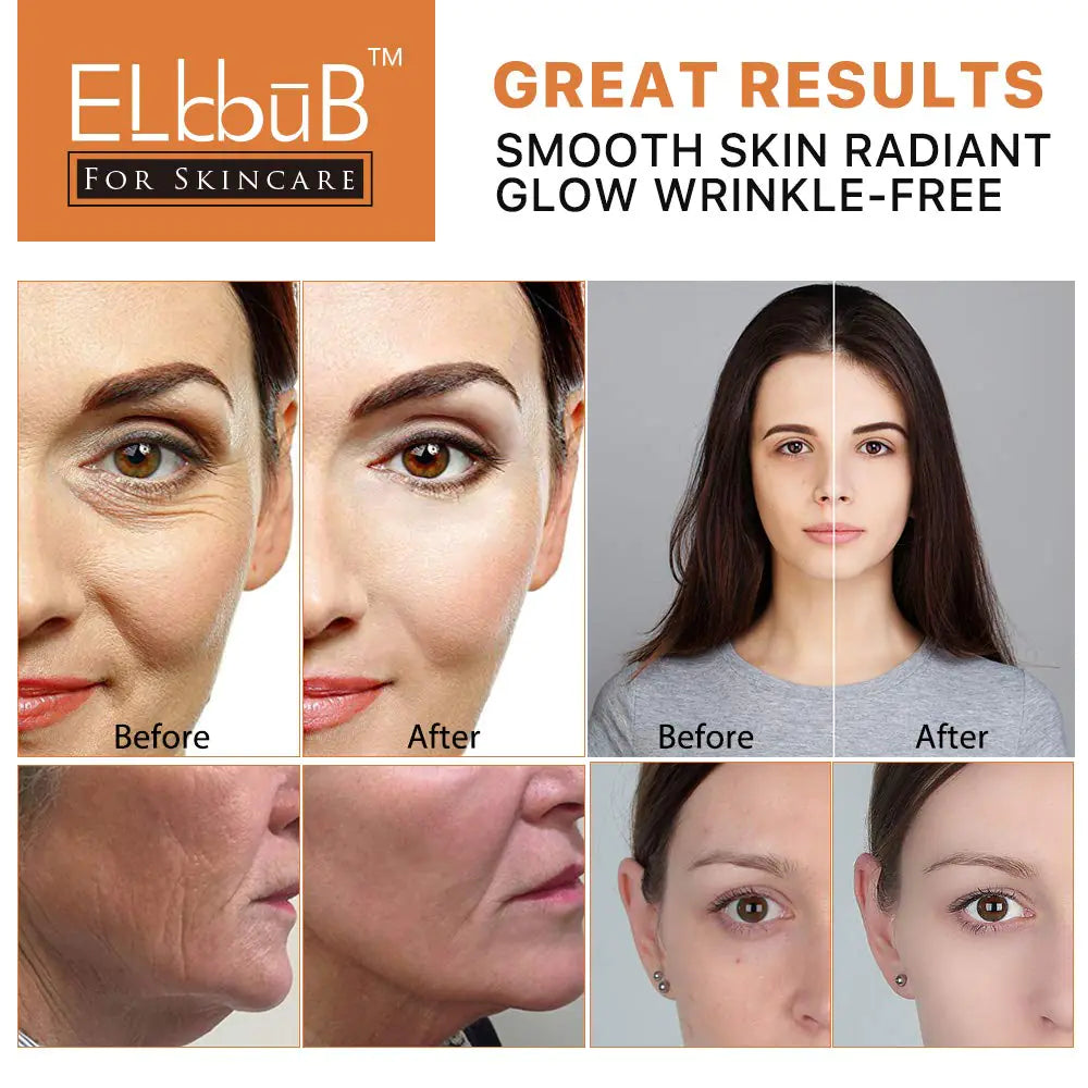 ElbbuB Vitamin C Potent Anti-Aging Serum (20%)