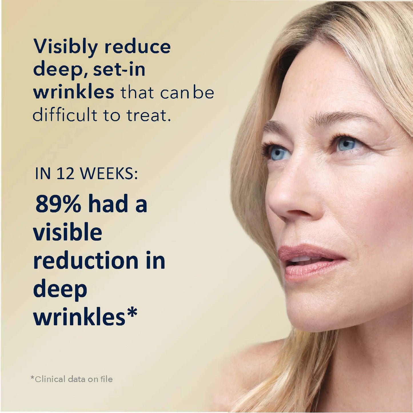 RoC Retinol Correxion Face Serum