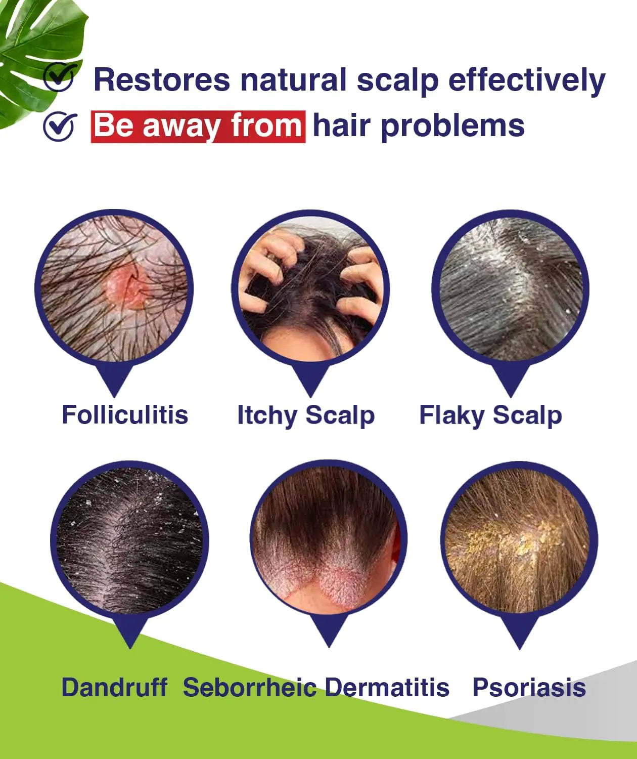 Pharmbanner Folliculitis Shampoo