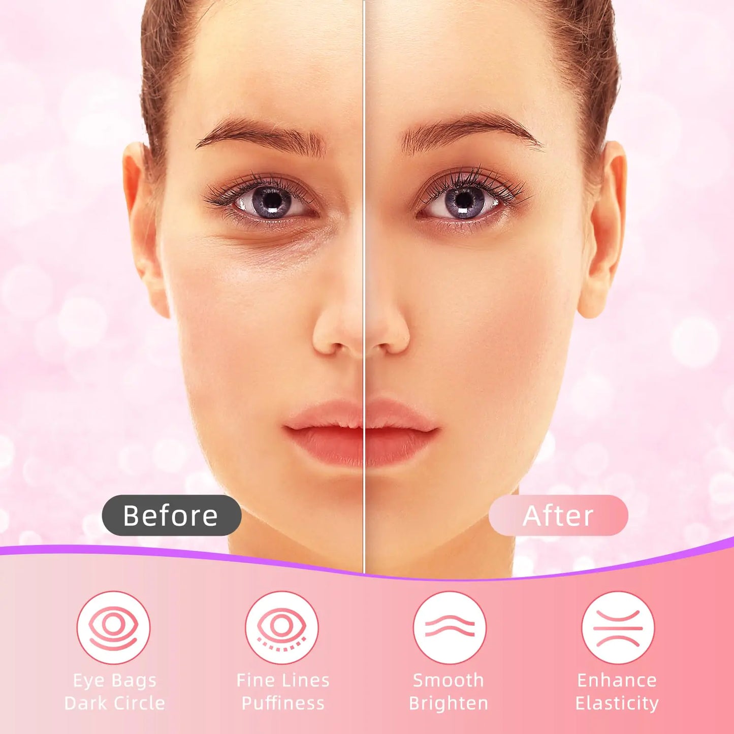 Ustelir Under Eye Rejuvenation