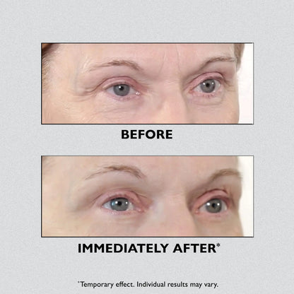 Peter Thomas Roth Eye-Tightener