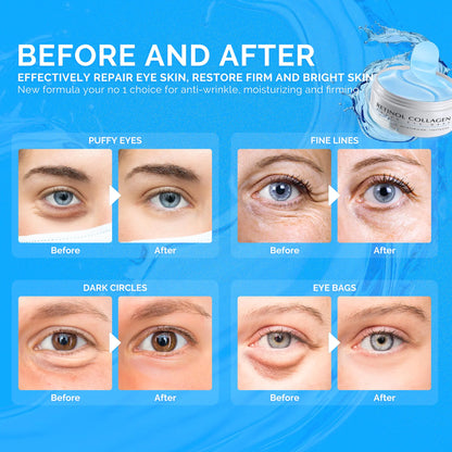 EnaSkin Naturals Under Eye Patches