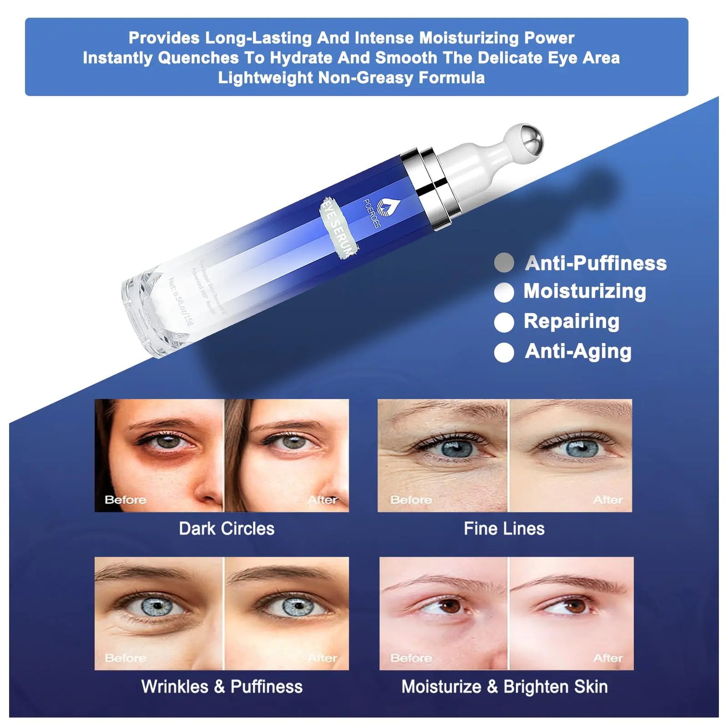 POEROES Under Eye Treatment